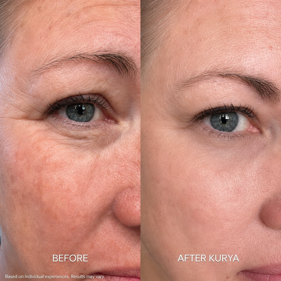 Before and after