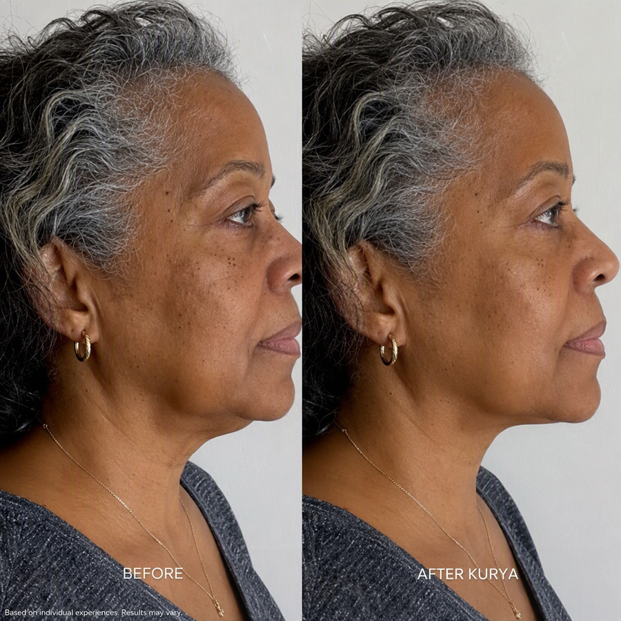 Before and after