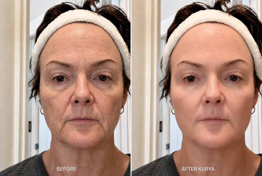 Before and after